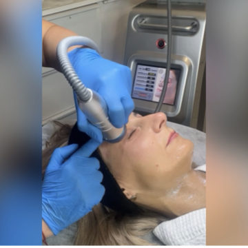 Radiofrekwencja mikroigłowa – najsilniejszy lifting 3D